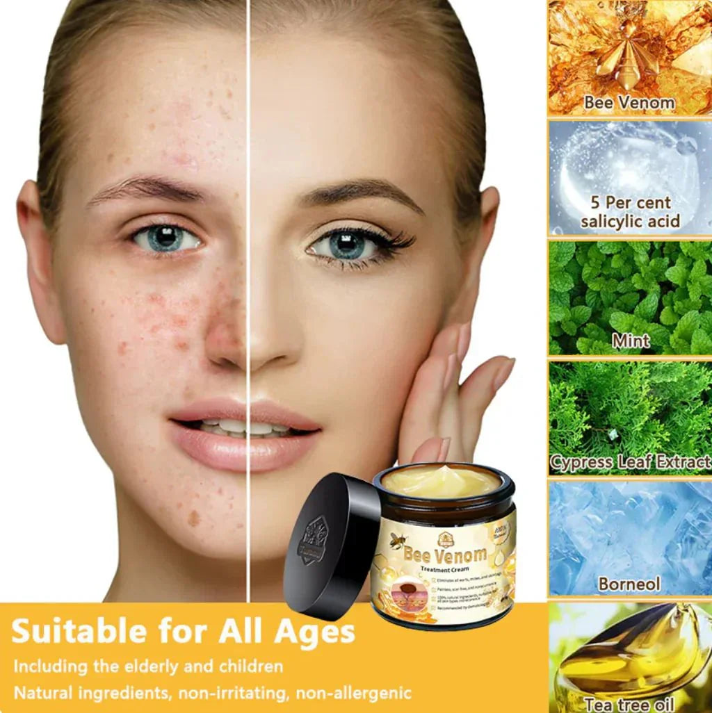 Bee Venom Body Cream – Natural Herbal Skin Comfort Elixir