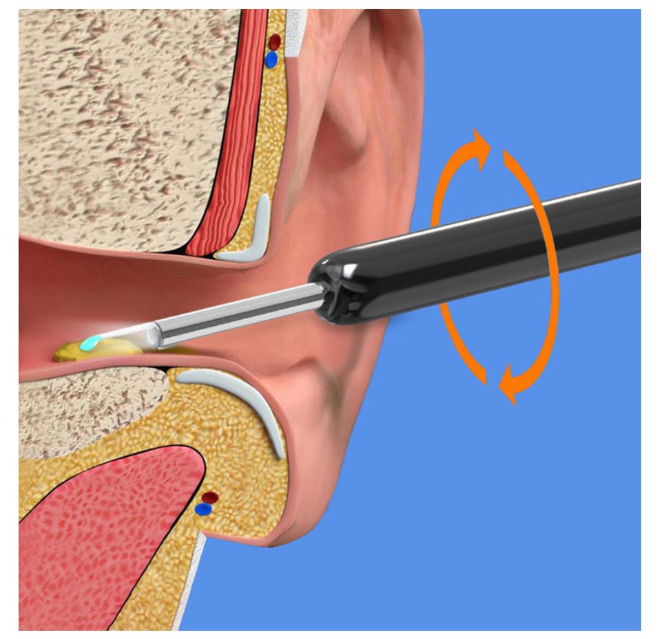 Smart Visual Earwax Removal Kit – Safe LED Camera Ear Cleaner