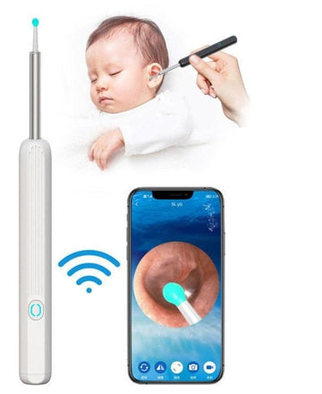 Smart Visual Earwax Removal Kit – Safe LED Camera Ear Cleaner