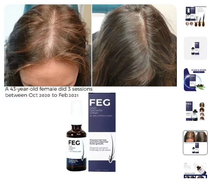FEG Hair Growth Spray + Derma Roller Set (Pack of 2) – Men & Women